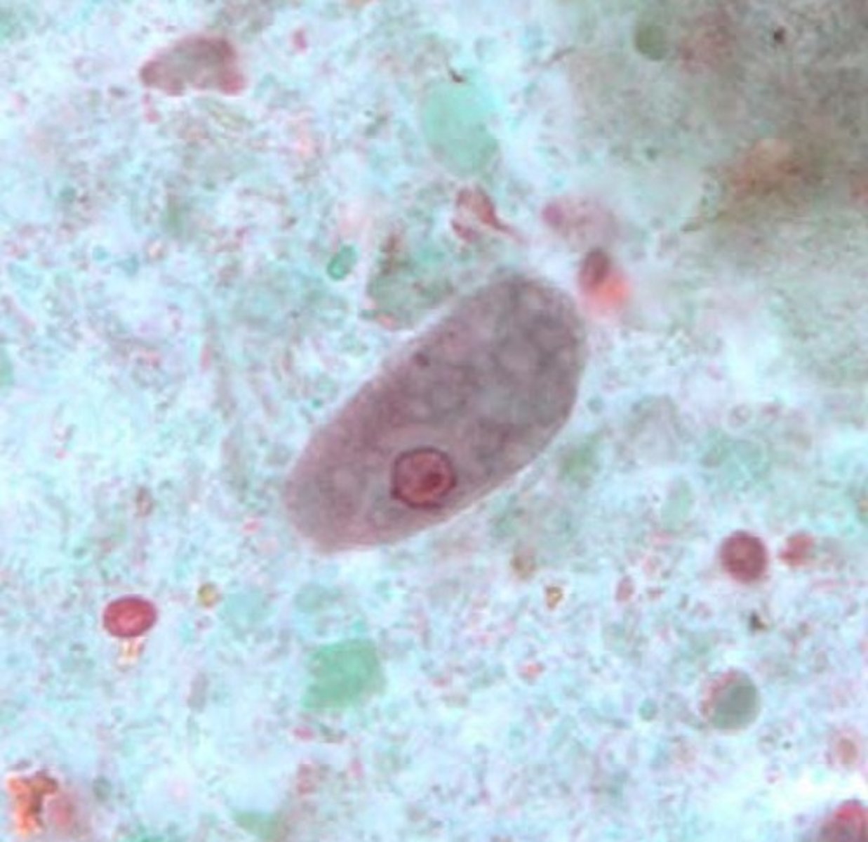 <p>b. Entamoeba coli</p>