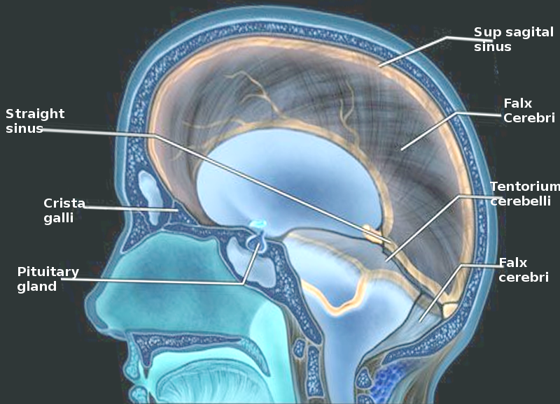 <ul><li><p>seperation between endosteal and meningial layers.&nbsp;</p></li><li><p>Dural folds / septa =&nbsp;</p><ul><li><p>falx cerebri and falx cerebelli. </p></li><li><p>Tenrorium cerebelli </p></li><li><p>Diaphrama sellae </p></li></ul></li></ul><p></p>