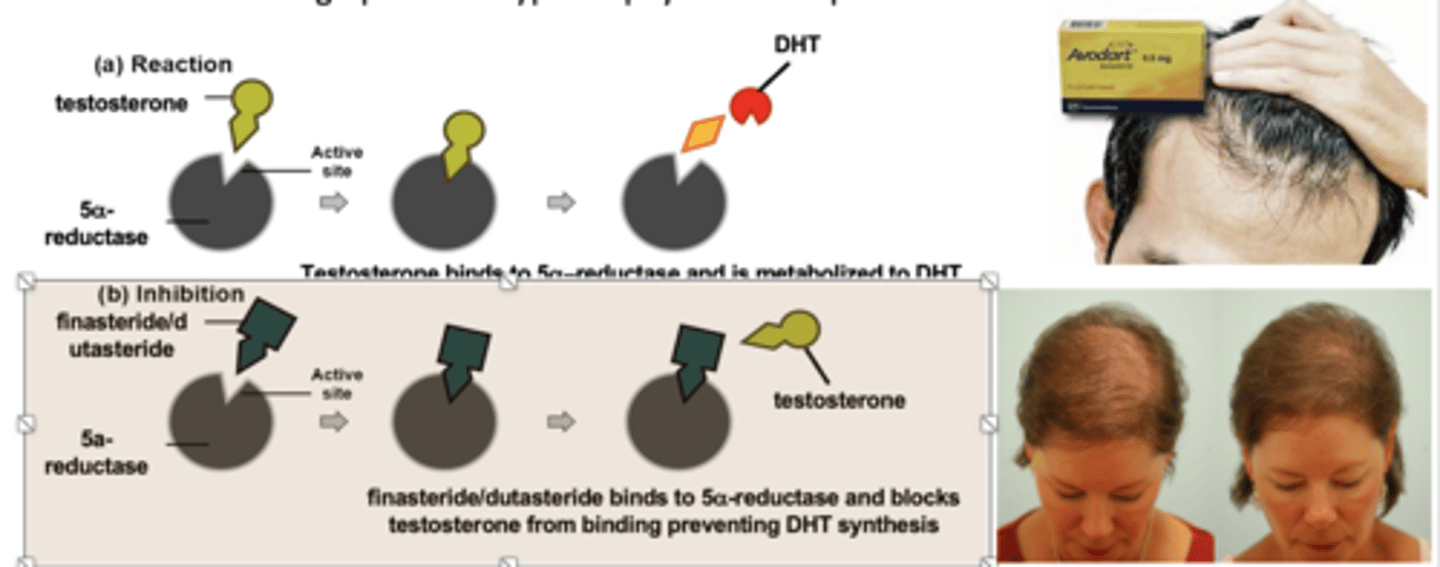 <p>Used to treat benign prostatic hypertrophy and male patterned baldness</p>