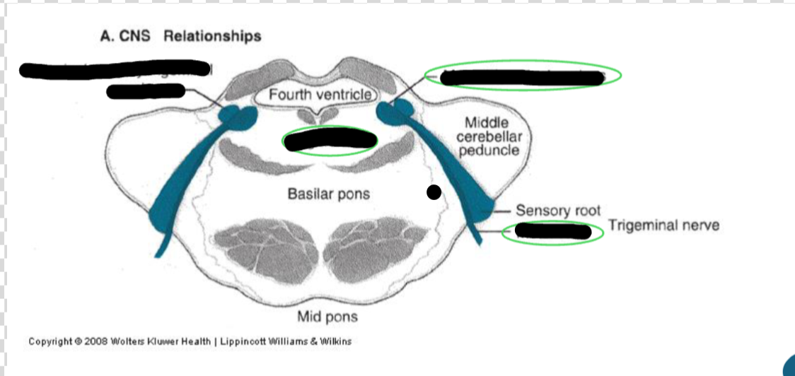 <p>what CN is the picture showing?</p>