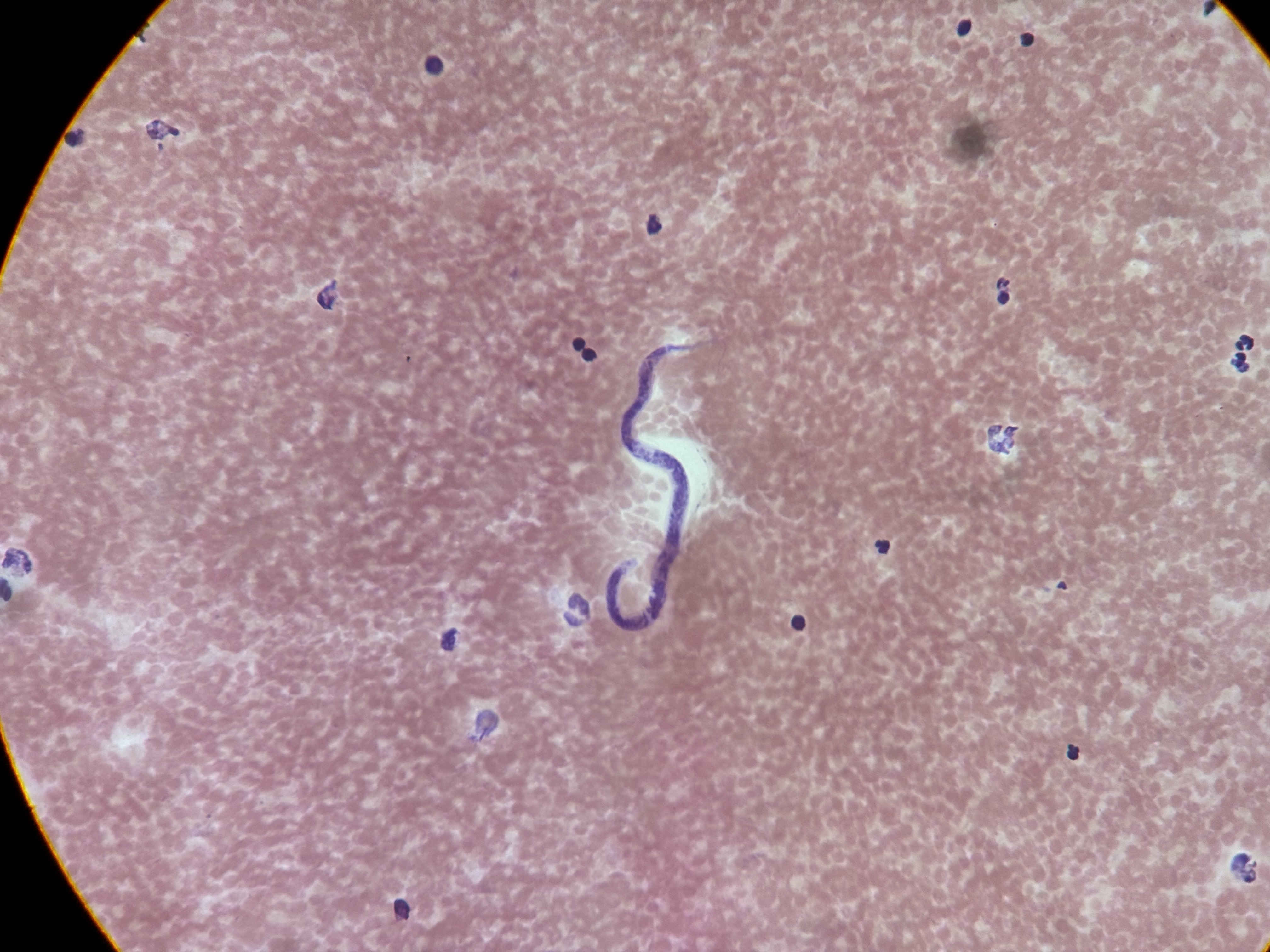<p>Dirofilaria immitis</p>