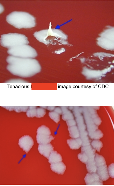 <p>DNA hybridization. culture: aerobic, nonhemolytic “ground glass” that are tenacious (sticky), curling (medusa head), capsulated, nonmotile, long chains. </p>