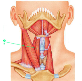 <p><span>Identify the indicated muscle.</span></p>