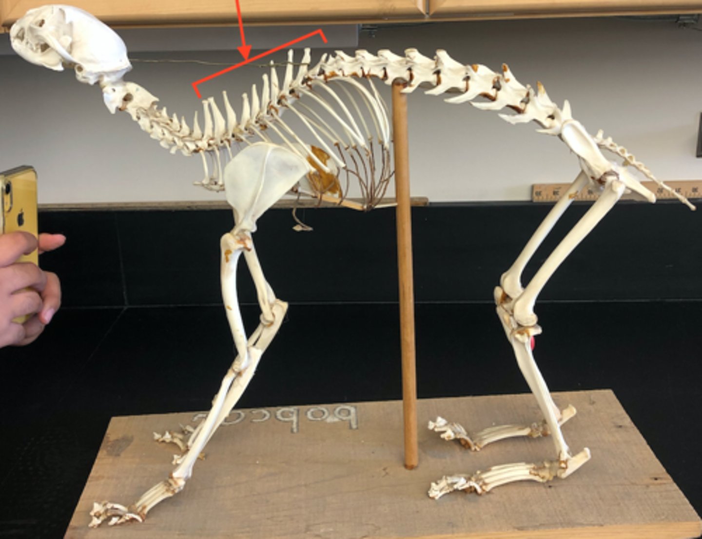 <p>Very tall spinous processes</p>