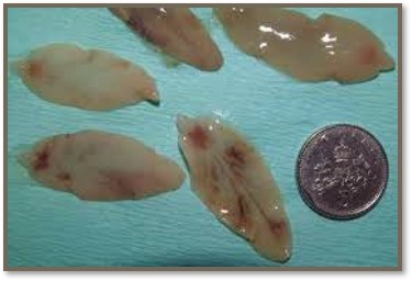 <p>Liver fluke</p>