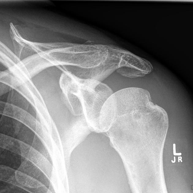 <p>Describe the abnormality demonstrated.</p>