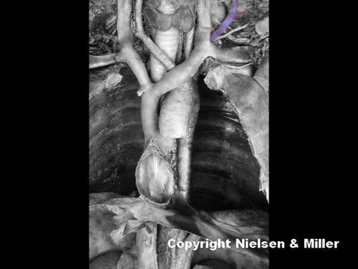 <p>Identify the highlighted vessel</p>