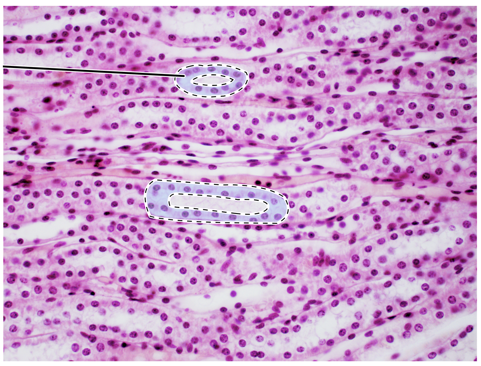 <p>Name the highlighted tissue.</p>