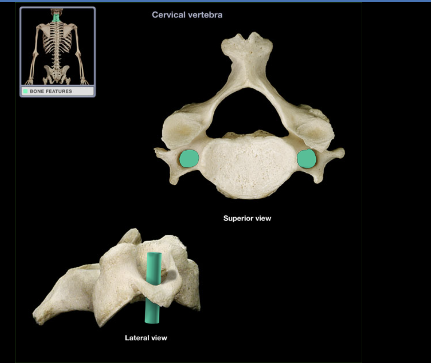 <p>what component of cervical vertebrae is this? (only cervical)</p>