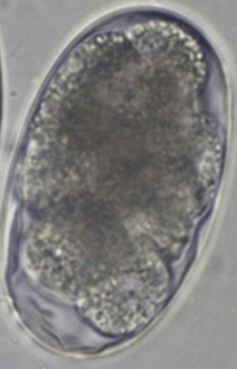 <p>Dog with weight loss and anaemia. What parasite species does this egg belong to?</p>