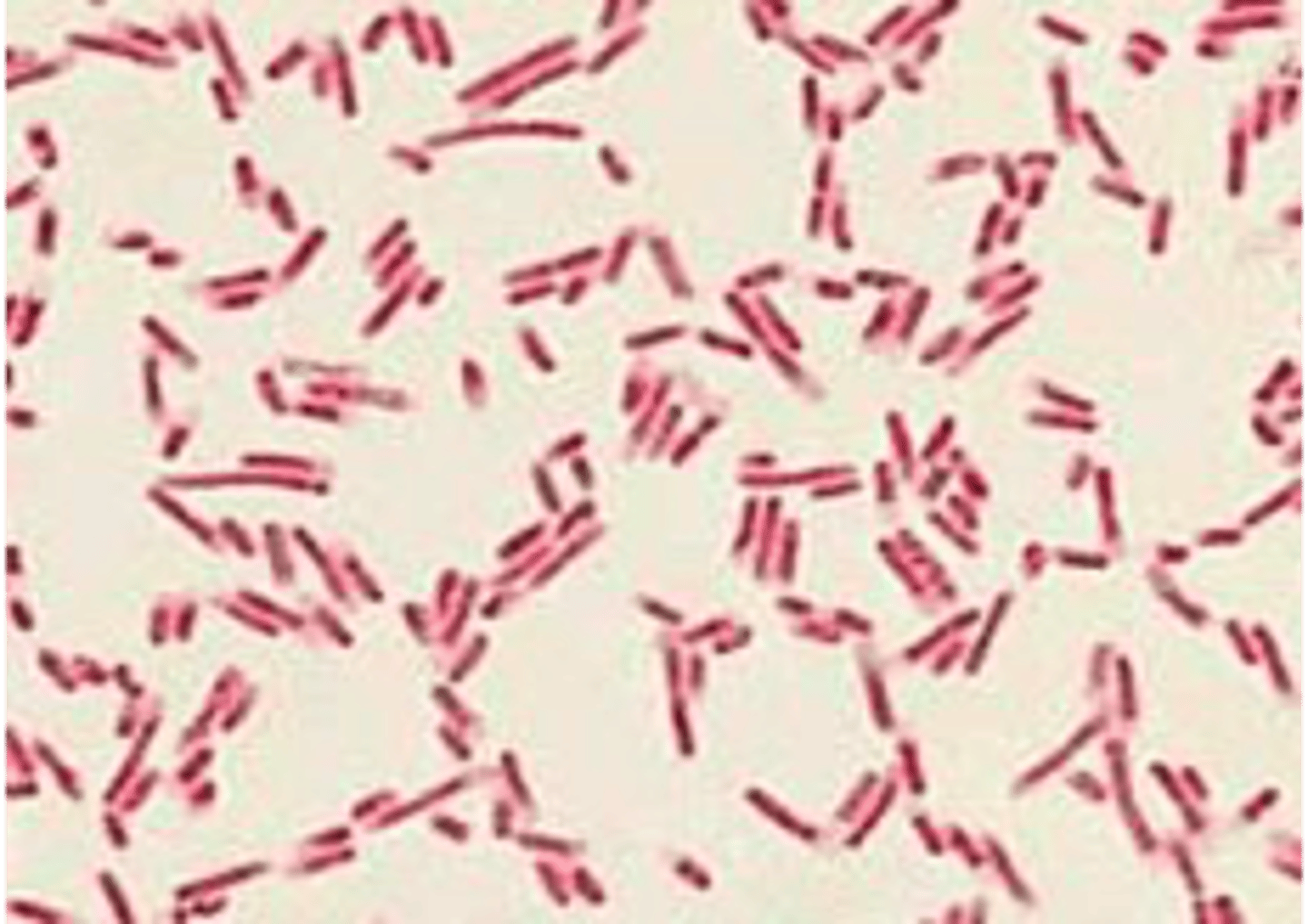 <p>what pathogen is indicated in this image</p>
