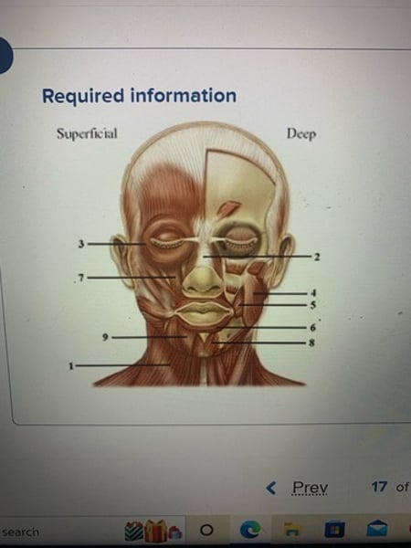 <p>Platysma</p>