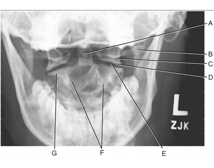 <p>What projection is this image?</p>