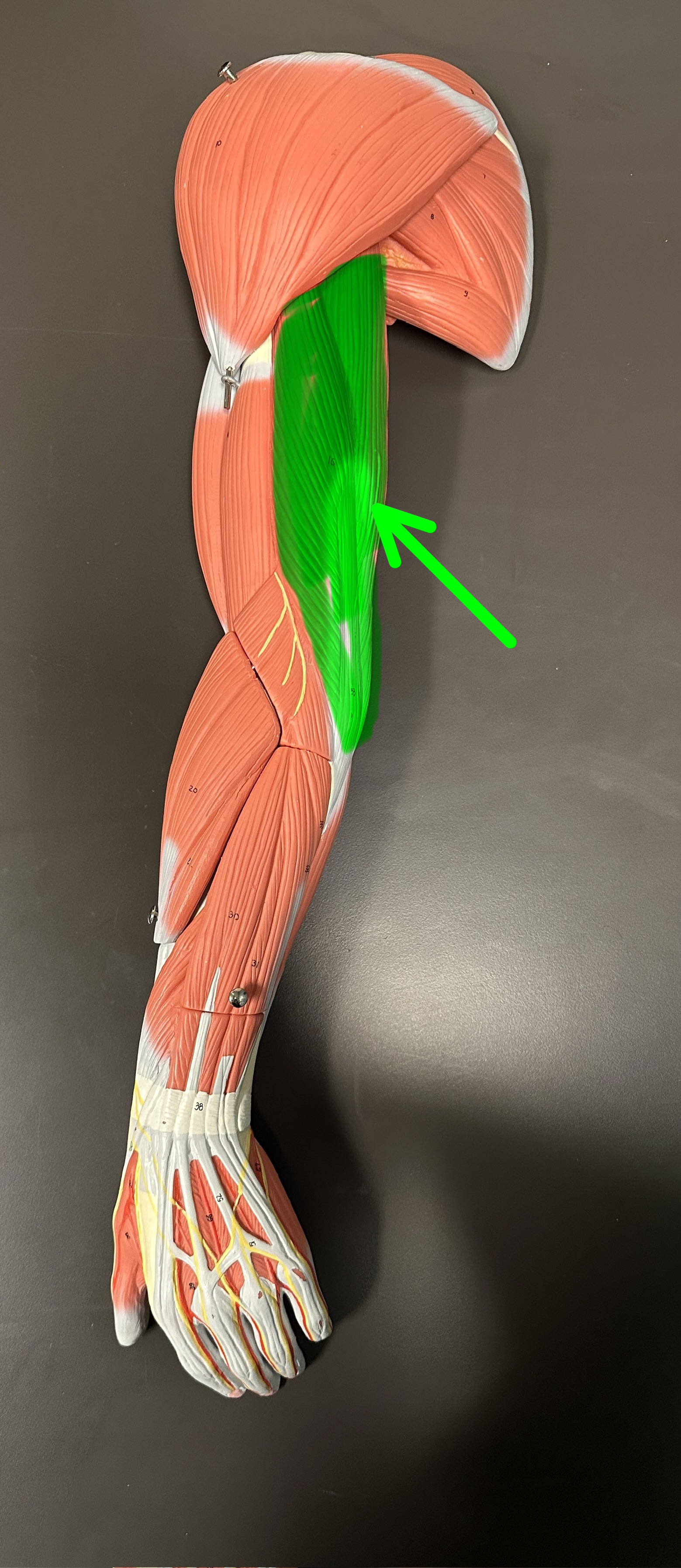 <p>What is the highlighted structure</p>