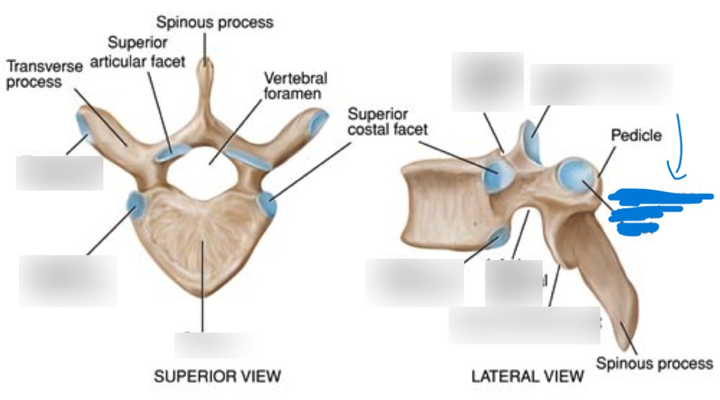 <p>What is this part of the vertebrae?</p>