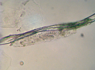 <p>Identify the urine sediment element shown:</p>