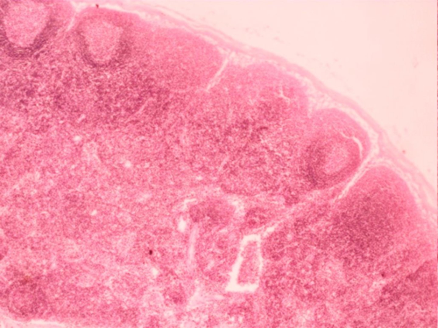 <p>ID structure</p><p>lymph node</p><p>cortex & paracortex</p>