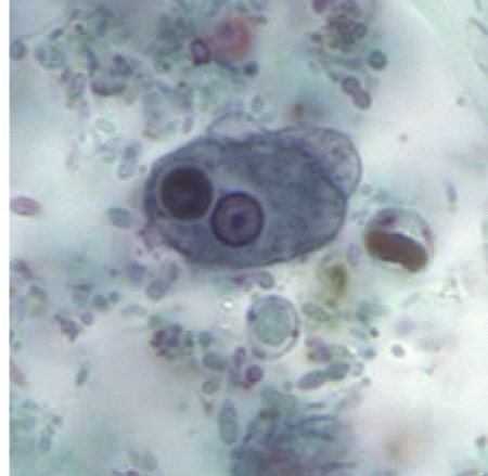 <p>Identify: Protozoa</p>