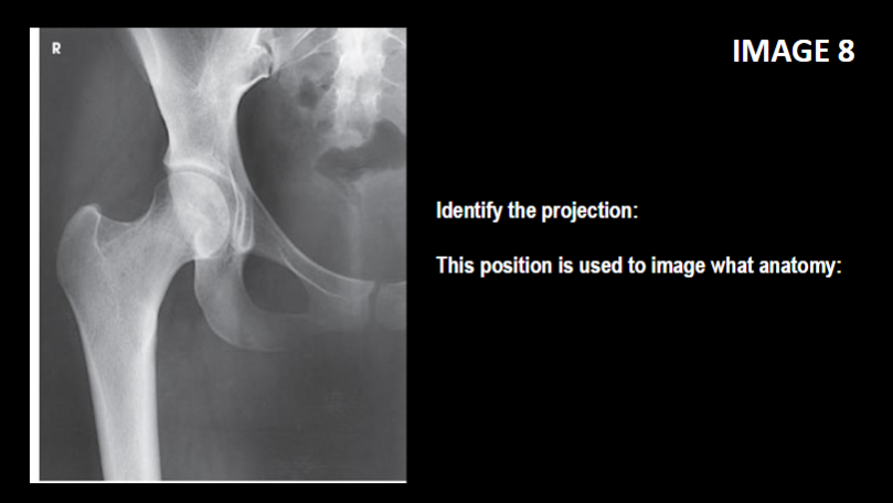 <p>this position is used to observe what anatomy </p>