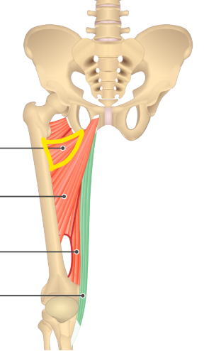 term image