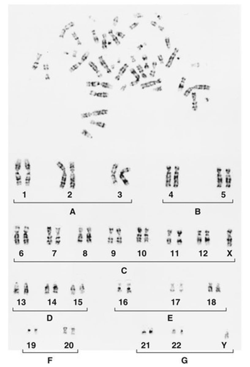 <p>The number and appearance of chromosomes in the nucleus of a eukaryotic cell.</p>