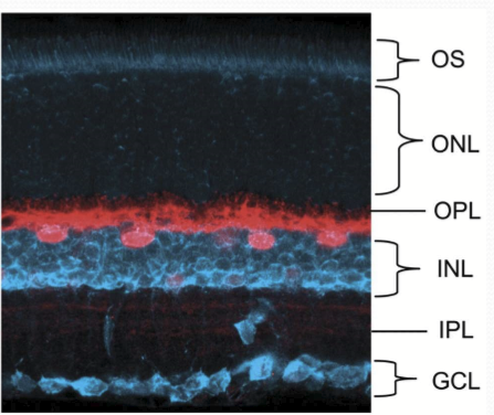 <p>Lateral inhibition by:</p><ul><li><p>Feedback mechanism to limit glutamate release from photoreceptors. </p></li><li><p>Enhances image contrast</p></li><li><p>Facilitates color discrimination</p></li><li><p>Assists light adaptation </p></li></ul><p></p>