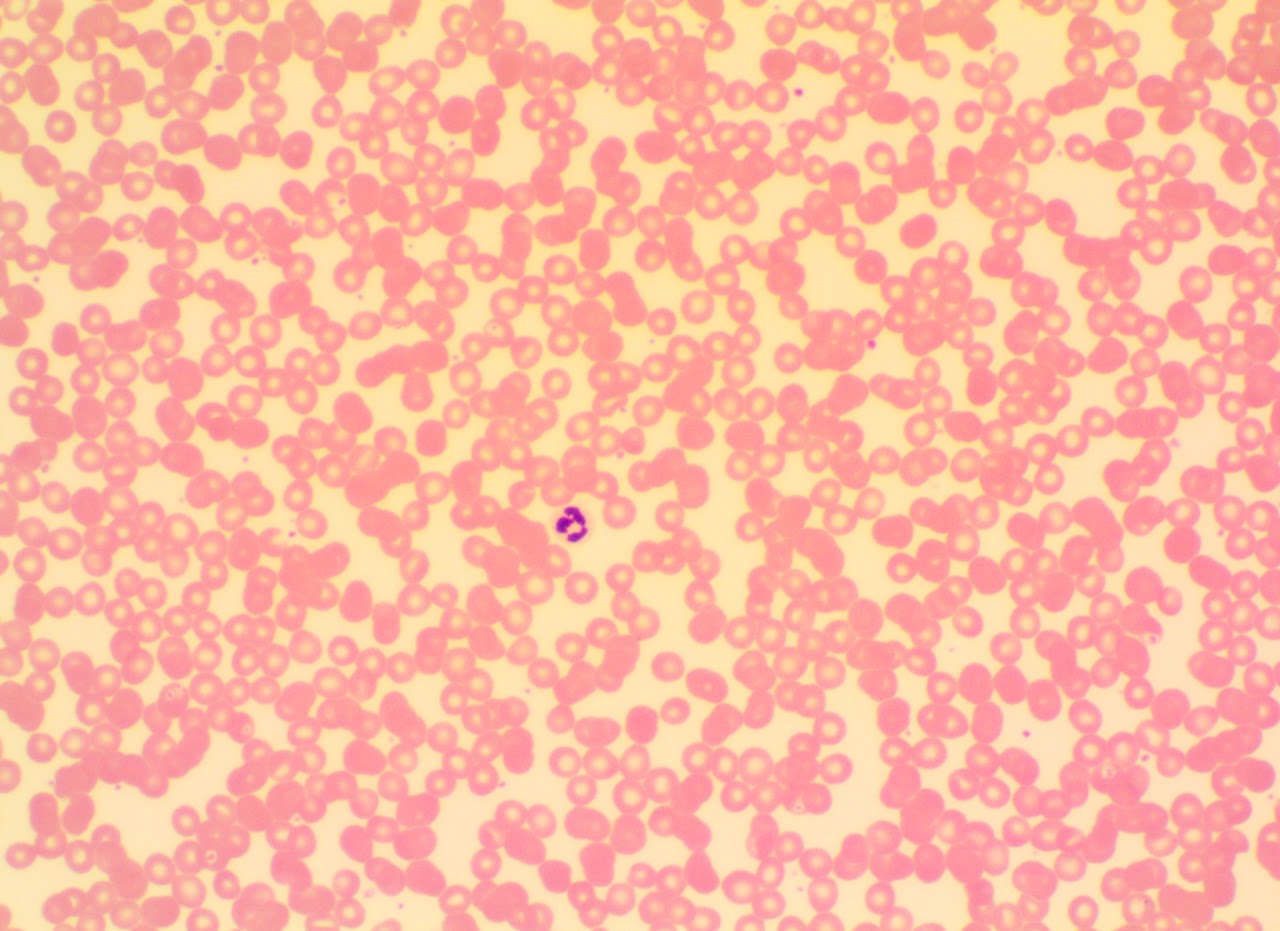<p>Blood connective tissue</p>