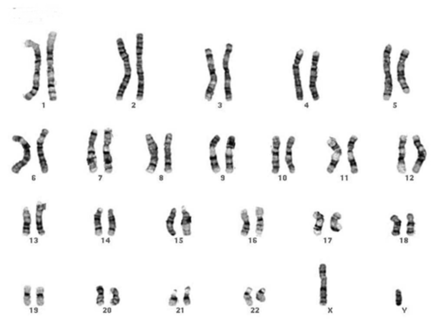 <p>A picture of all the chromosomes in a cell arranged in pairs</p>