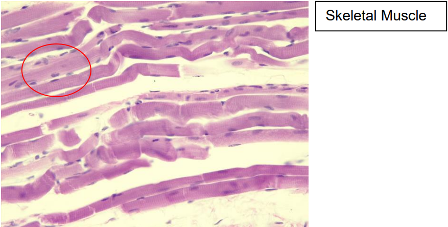 <p>Chacteristics: Long cells, multiple nuclei, and striations</p><p>Function: Generate force for voluntary movement</p><p>Location: Next to bone</p>