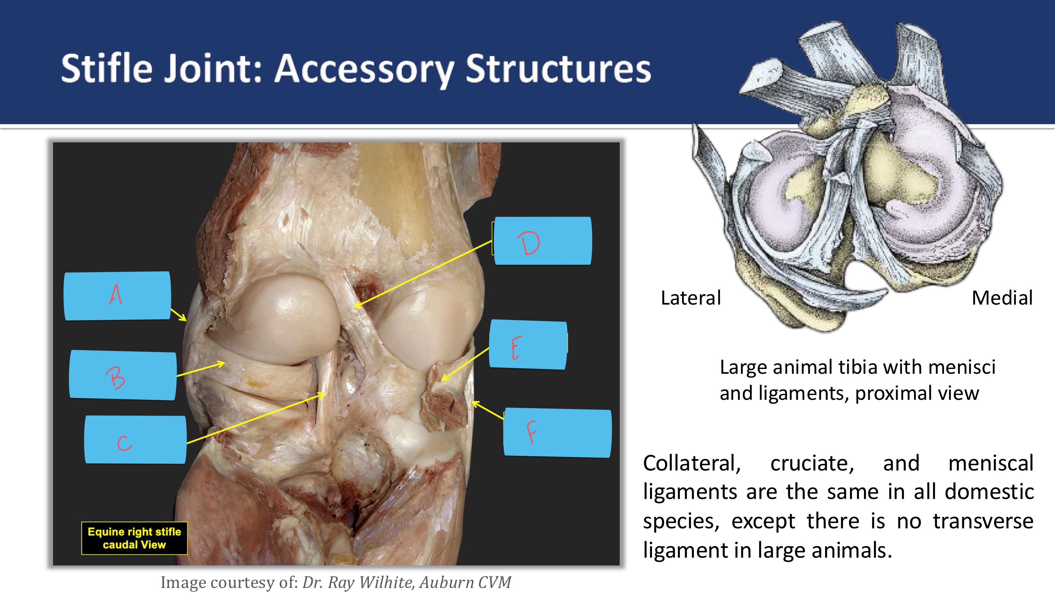 <p>medial collateral ligament</p>