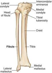 <p>Tuberosity vs Tubercle</p>