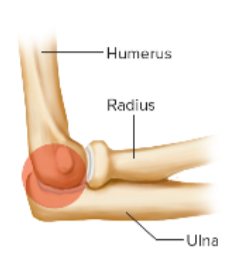 <p>What is this image an example of? </p>