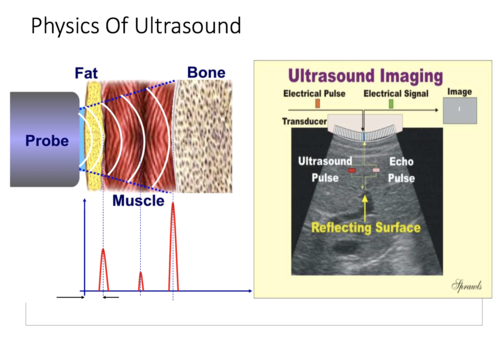breaking kidney stones, cleaning jewellery, ultrasound scans, echo sounding