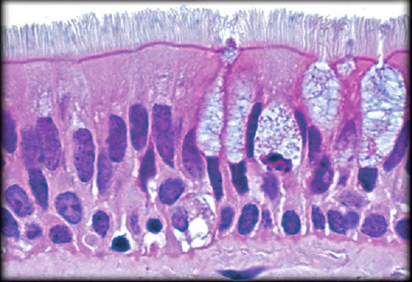 <p>ciliated tissue lines the trachea and much of the upper respiratory tract</p>
