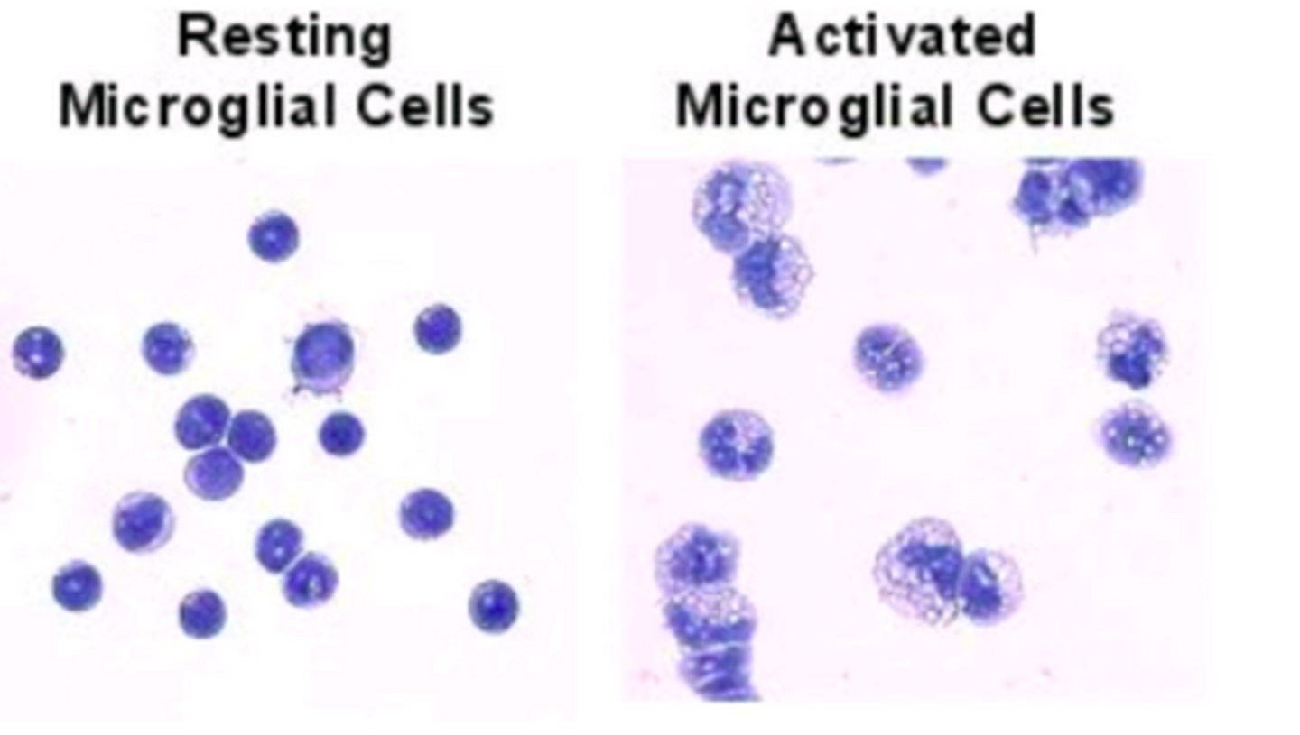 <p>Resting microglia.</p><p>They are surveying the area looking for inflammation. Once they detect it, the processes retract into the soma, and the microglia becomes a blob-like structure.</p>