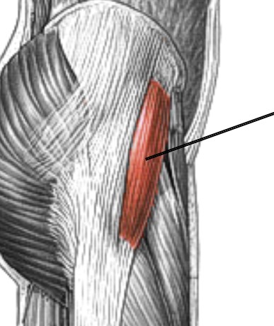 <p>Which muscle of the femur is:</p><ul><li><p>On lateral hip, pocket area</p></li><li><p>Action: prevents collapse of ext knee (locks knee)</p></li><li><p>Nerve: superior gluteal</p></li></ul><p></p>