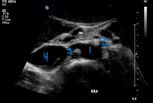 <p>What number is known as the RRA</p>