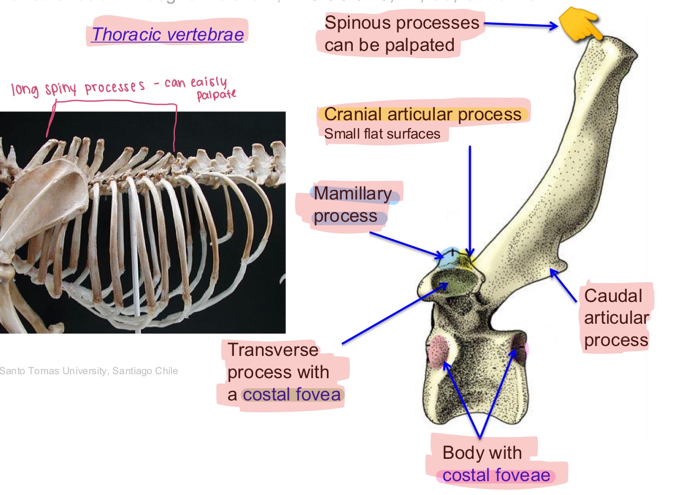 <p>Thoracic vertebra, thoracic 13</p>