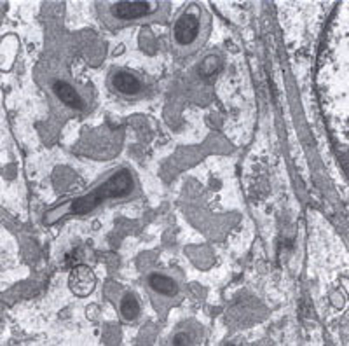 <p>characteristic lesions of verruga peruana on histology</p>