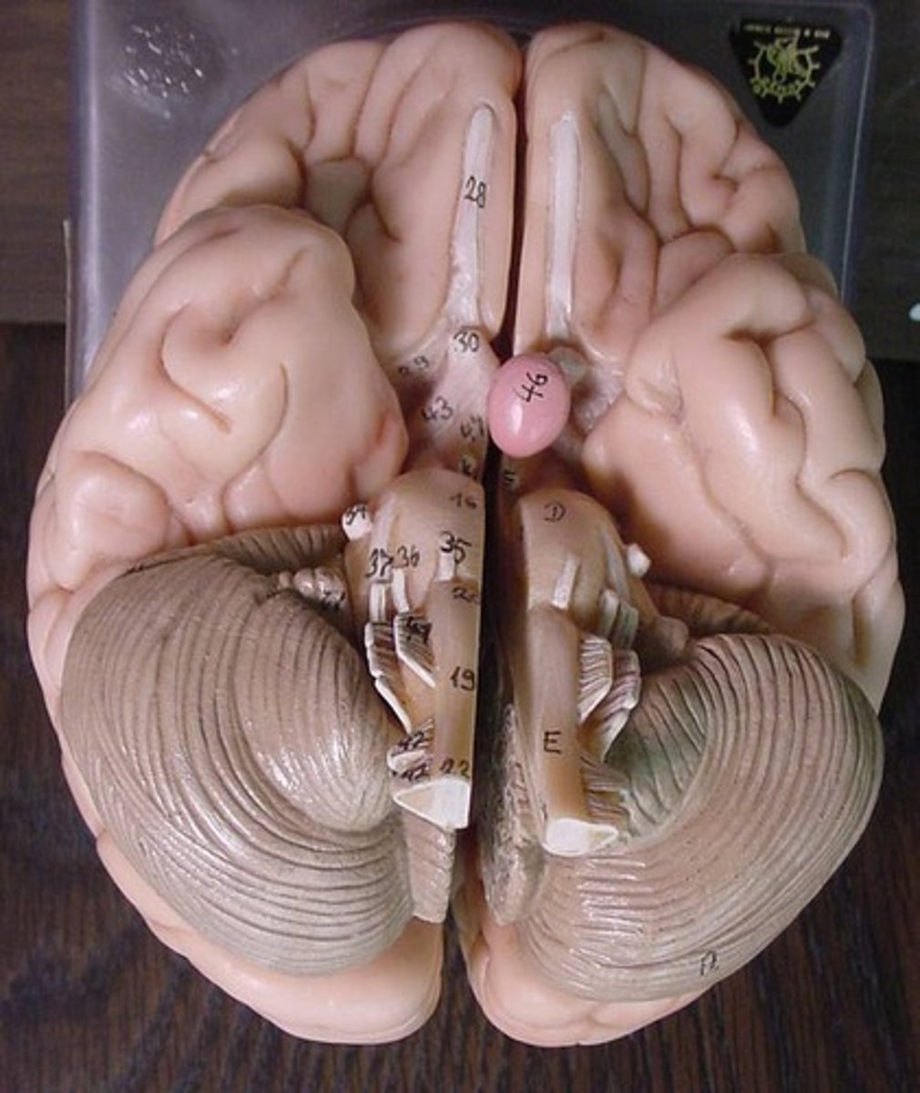 <p>What view of the brain would this be?</p>