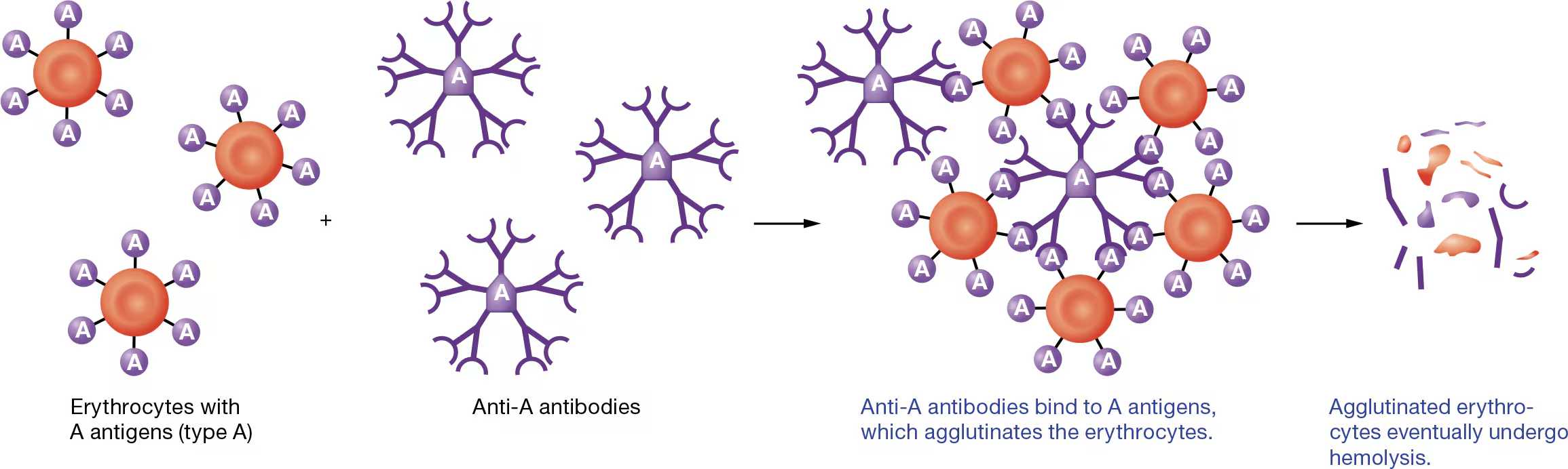 <ul><li><p>by using antibodies that recognize and bind to individual antigens on erythrocytes</p></li></ul><p></p><p>As you can see in <strong>Figure 19.18</strong>, antibodies cause bound antigens to clump together, or <strong>agglutinate</strong> (uh-GLOO-tuh-nayt). For this reason, antibodies are sometimes called <strong>agglutinins.</strong> Ultimately, agglutination promotes destruction of the erythrocytes, a reaction known as <strong>hemolysis</strong></p>