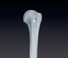 <p>small, knoblike process</p>