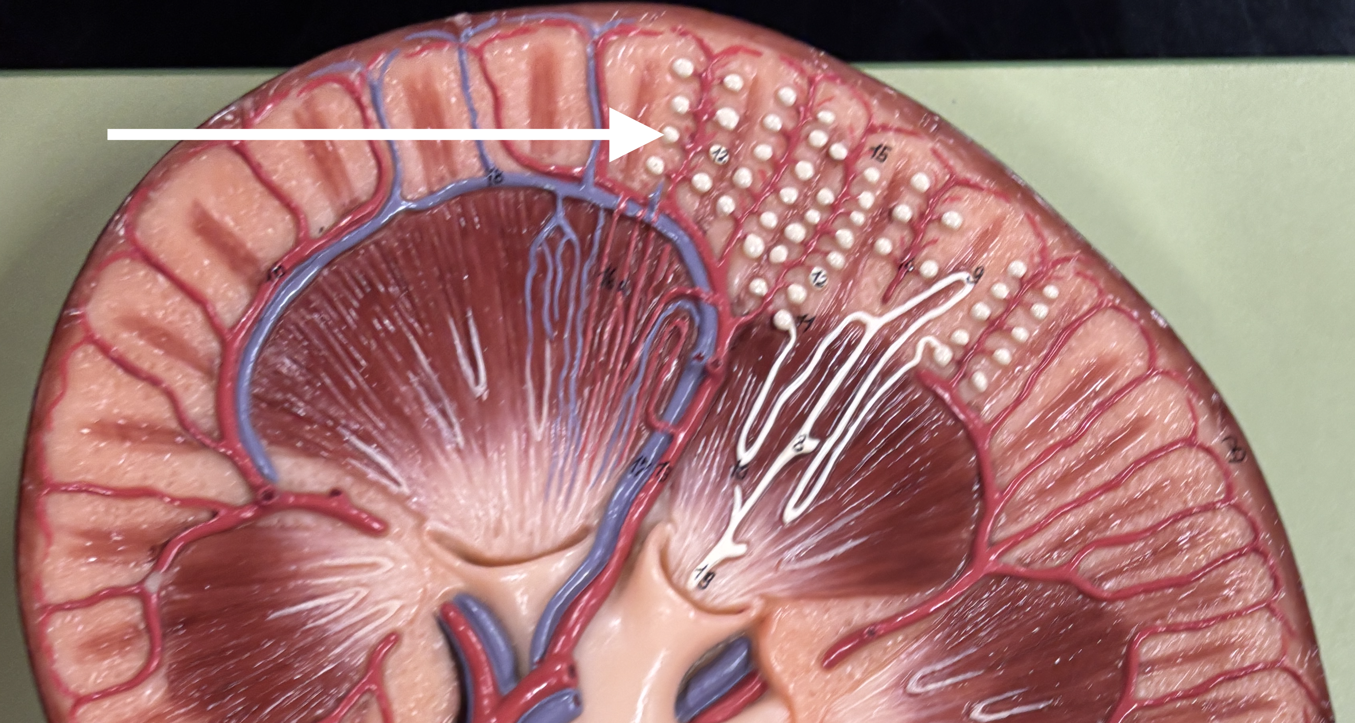 <p>what structure is the arrow pointing to? </p>
