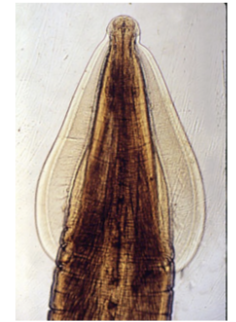 <p>Is more broad and end abruptly. Gives a more “arrow-head appearance </p>