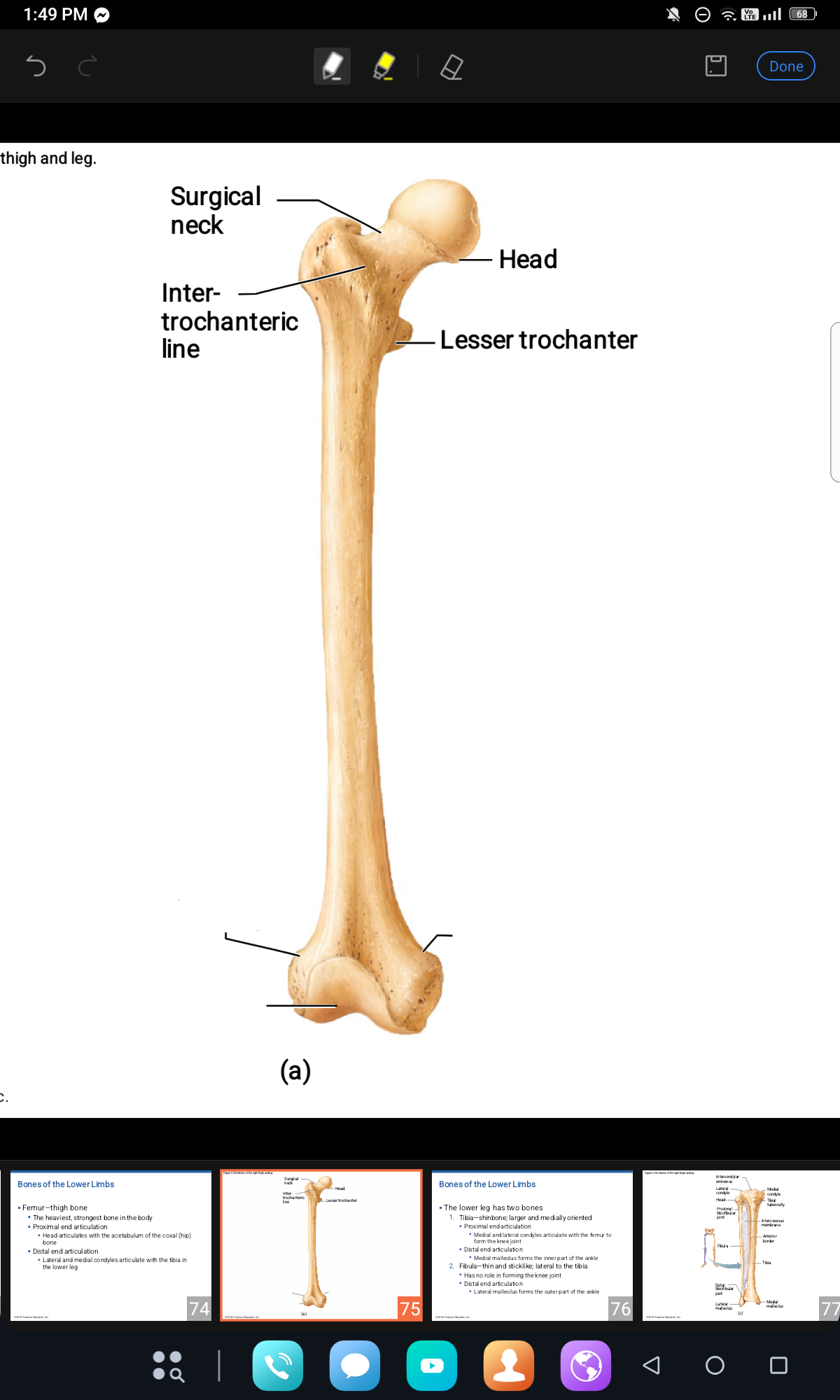 <p>LONG BONE PARTS (distal part of femur)</p>