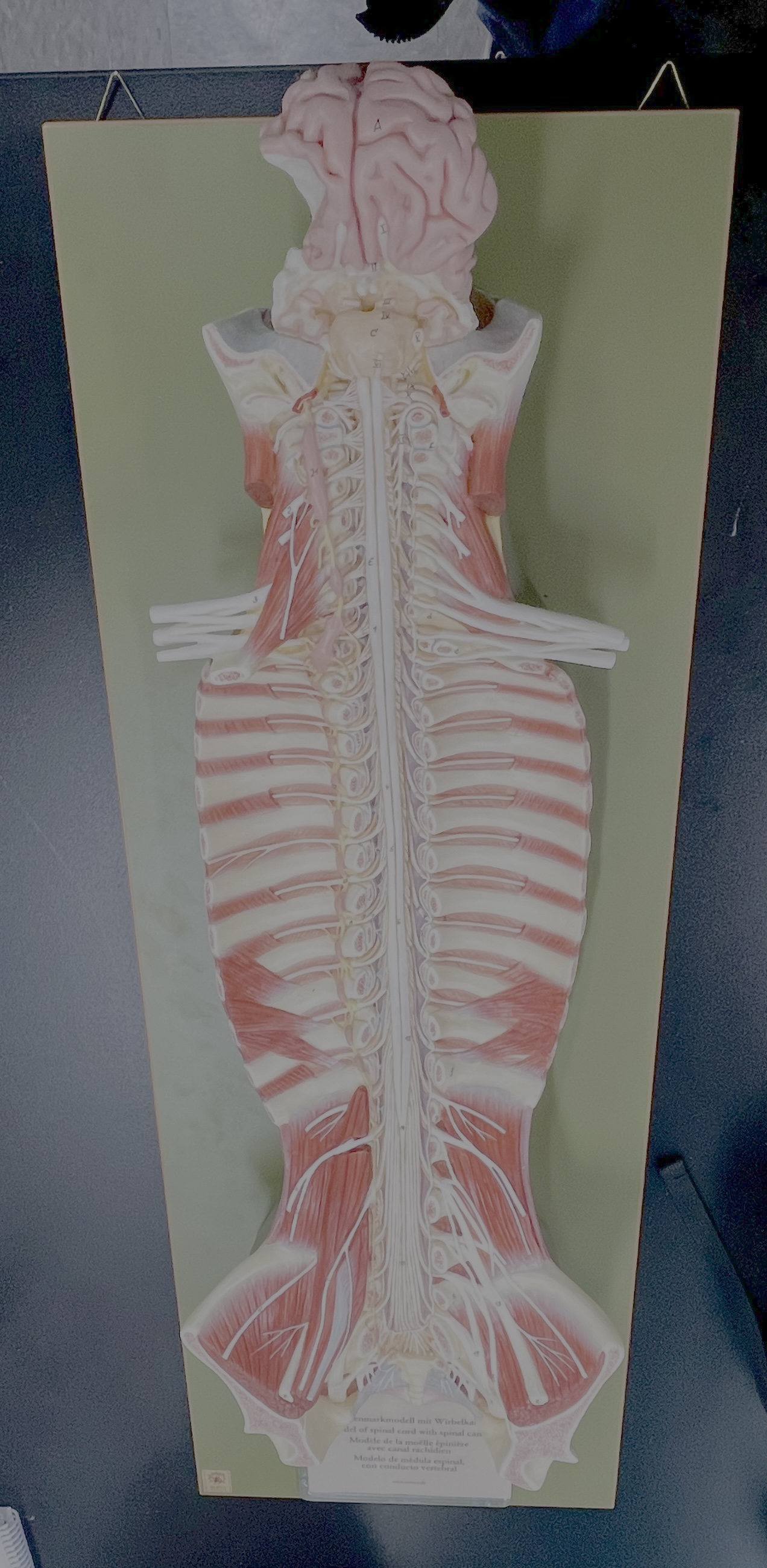 <p>sympathetic chain ganglia</p>