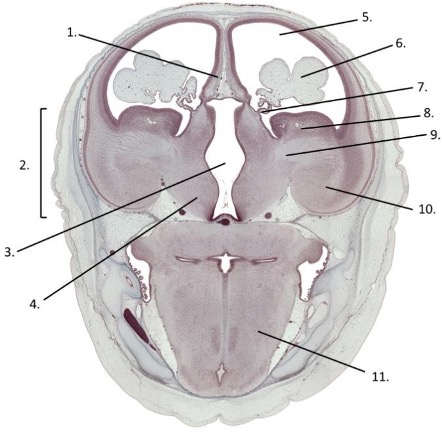 <p><span>Transverse section of a 56-day old human embryo in which the telencephalon, diencephalon and myelencephalon are visible</span></p>