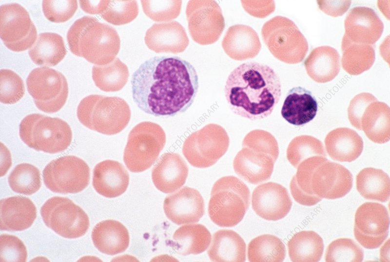 <p>vascular tissue (blood)</p>