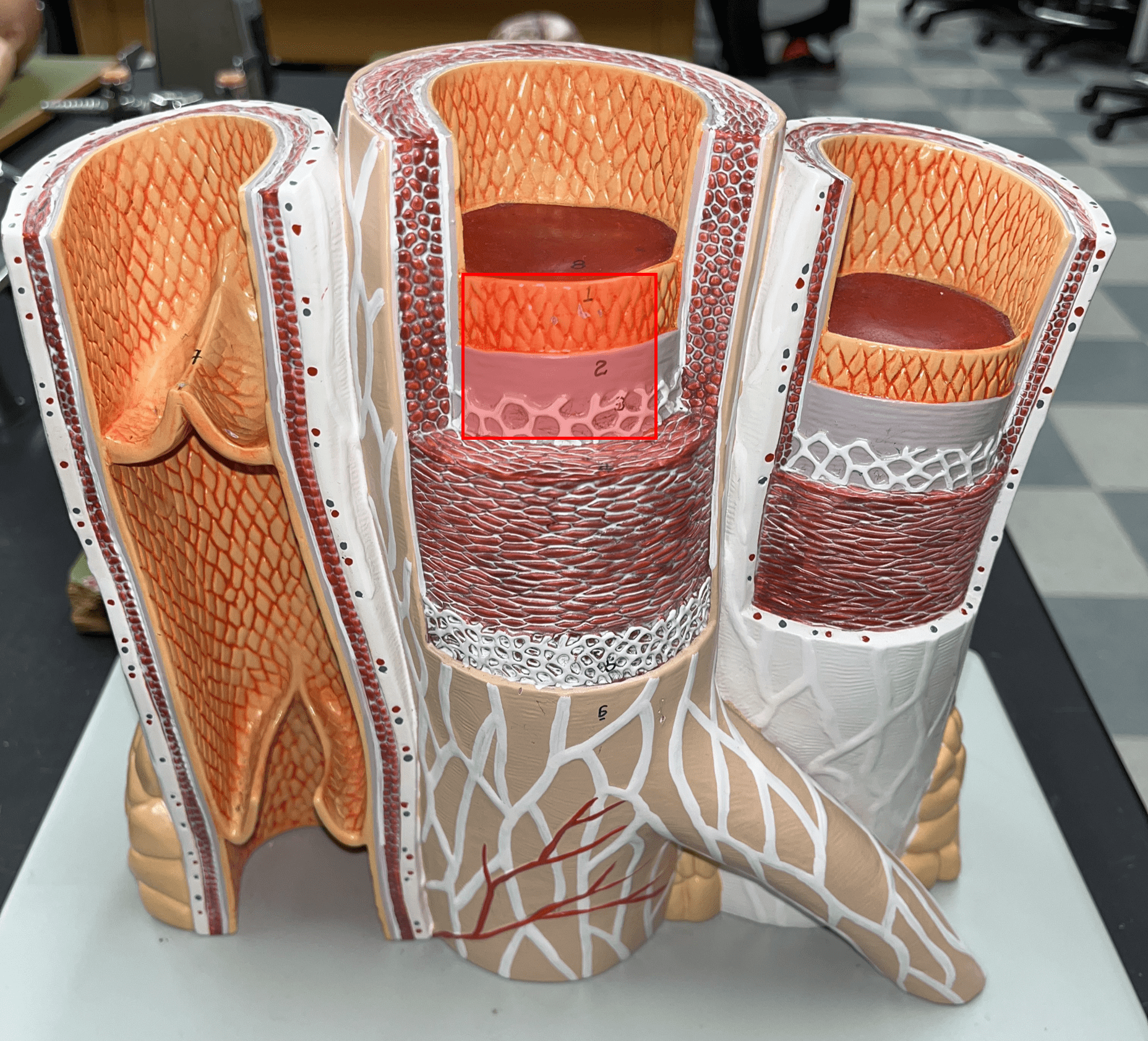 <p>• The innermost layer of an artery.</p>
<p>• Consists of an inner endothelium and an outer basement membrane.</p>
<p>• Also known as the tunica intima.</p>