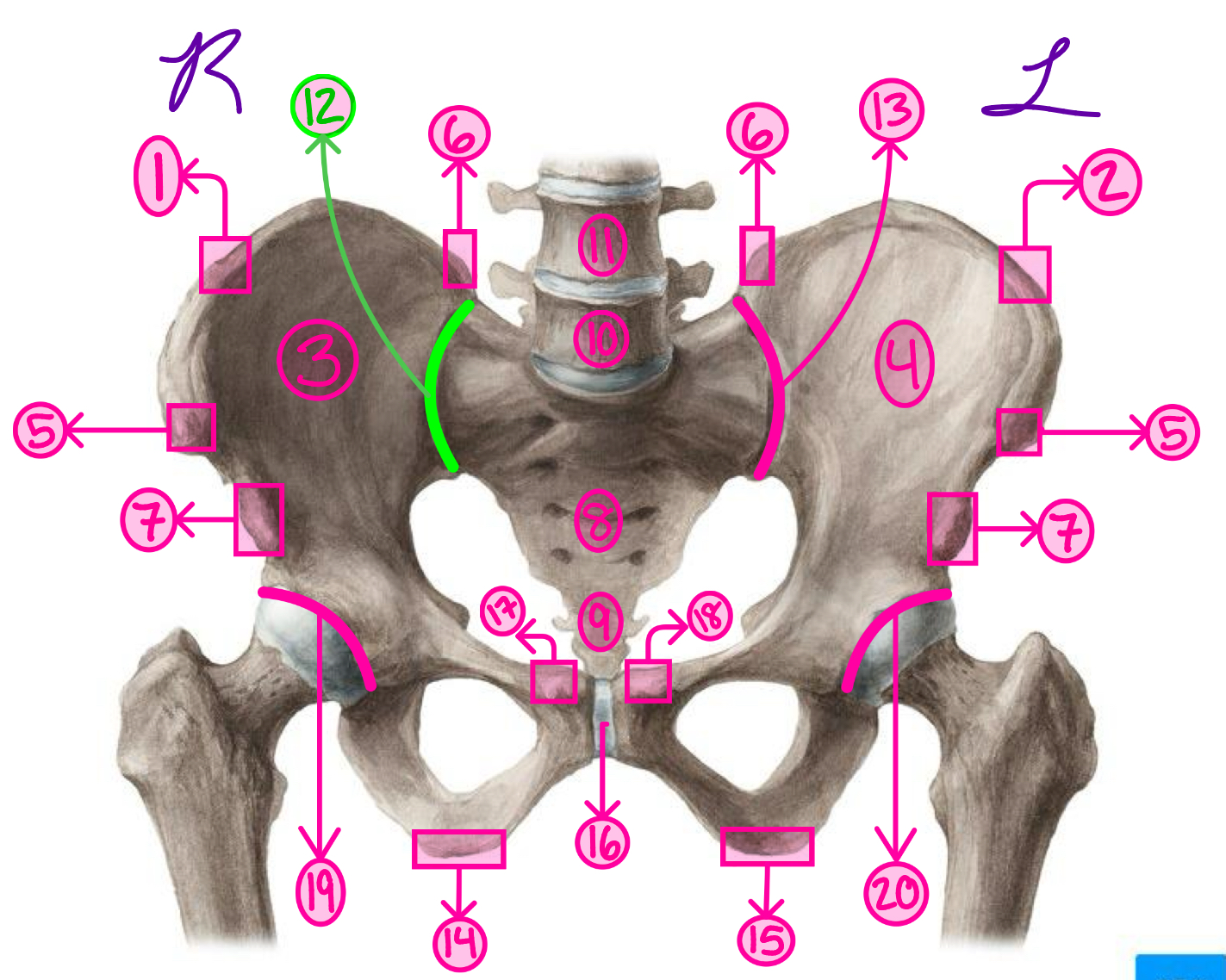 <p>Right sacroiliac joint</p>
